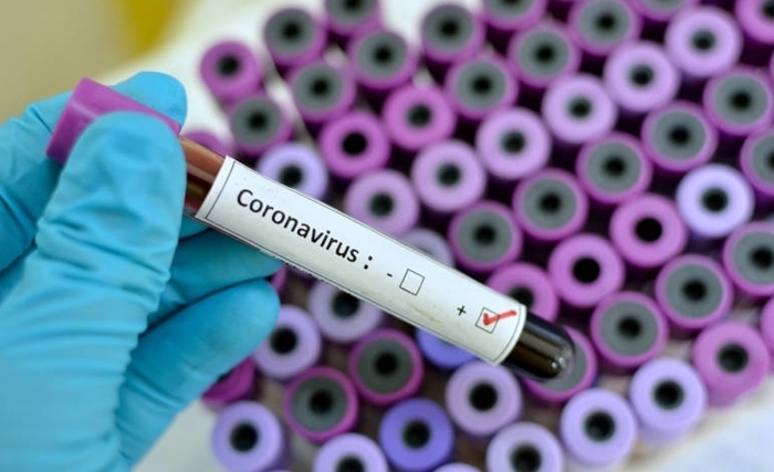 Général El Bekri : Quels risques de contagion par le Coronavirus en Tunisie ?